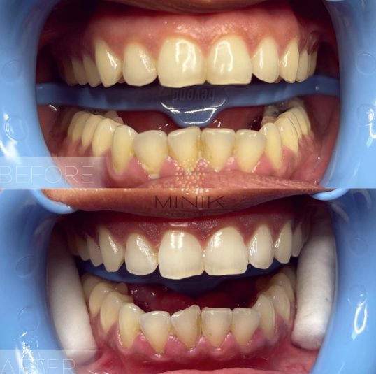 Training in Teeth Whitening - Image 6