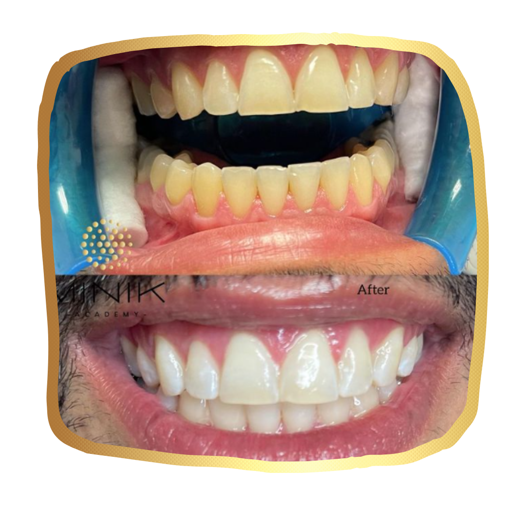 Training in Teeth Whitening - Image 3