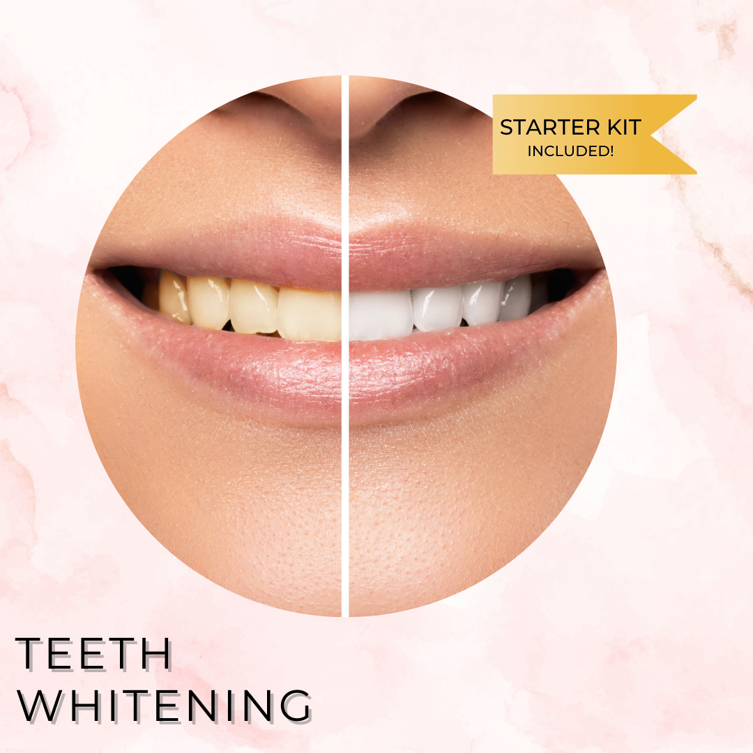 Training in Teeth Whitening
