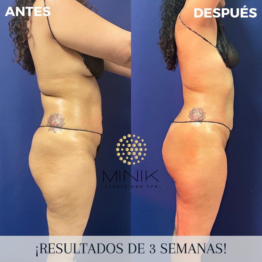 Minik Body Protocol Training - Image 2