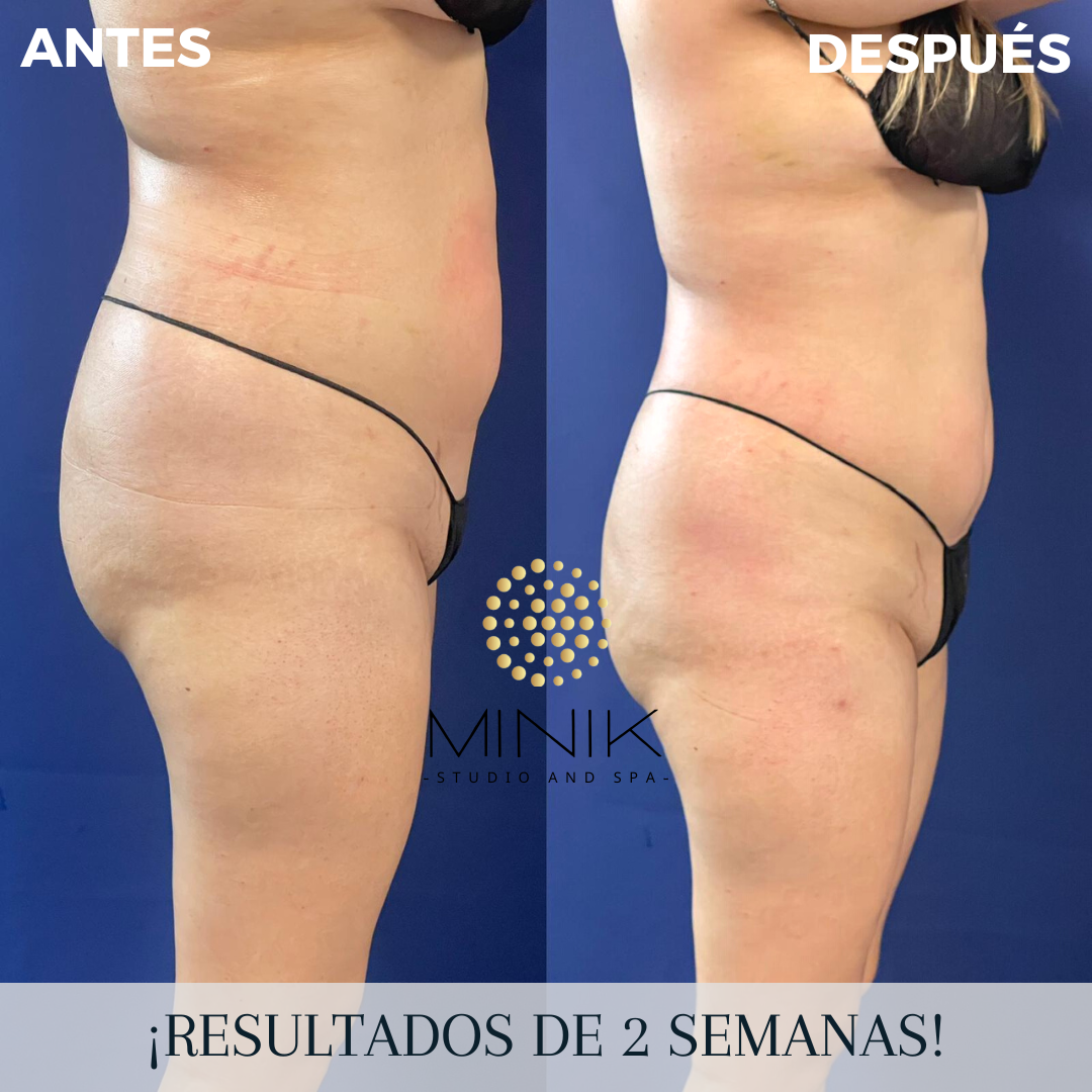 Minik Body Protocol Training - Image 3