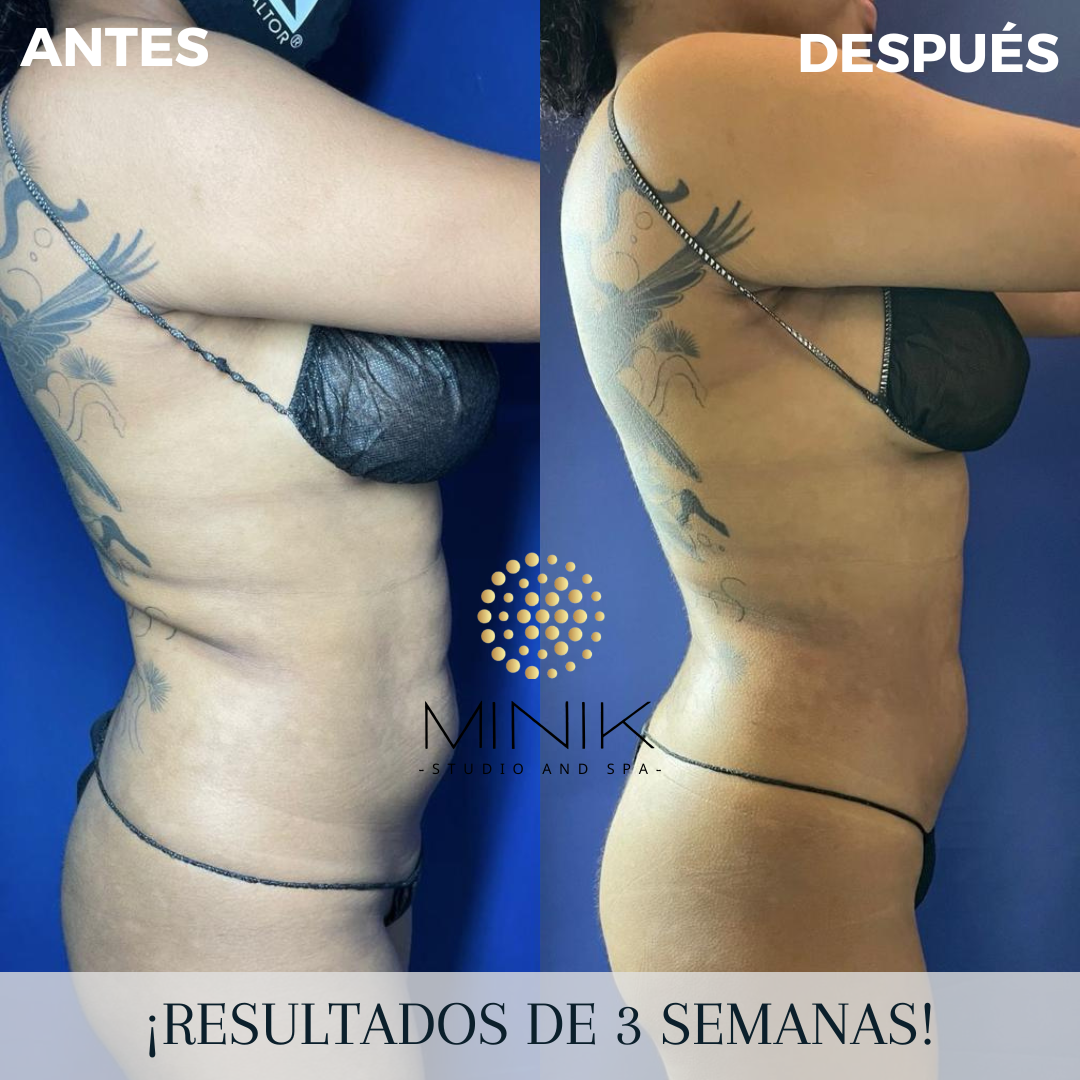 Minik Body Protocol Training - Image 4